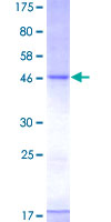 12.5% SDS-PAGE Stained with Coomassie Blue.